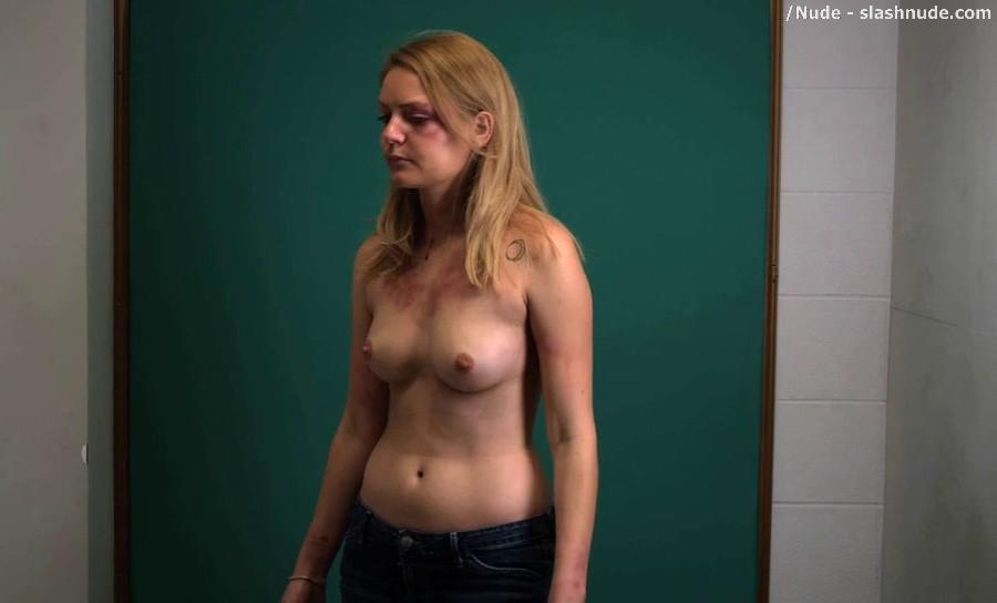 Hanna Hall Topless To Document Bruises In Scalene 11