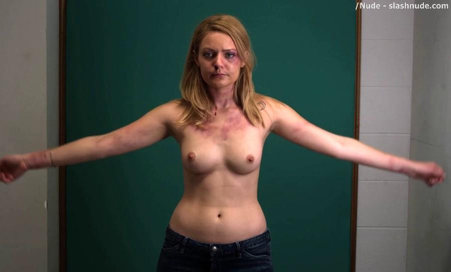 Hanna Hall Topless To Document Bruises In Scalene. 
